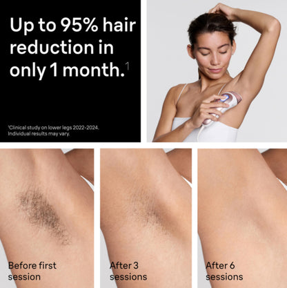 Braun Skin i-Expert Pro 7 IPL PL7219, smart app, 2 heads, full body use