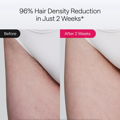 Ulike Air 10 IPL, ice-cooling, fast treatment, skin sensor included