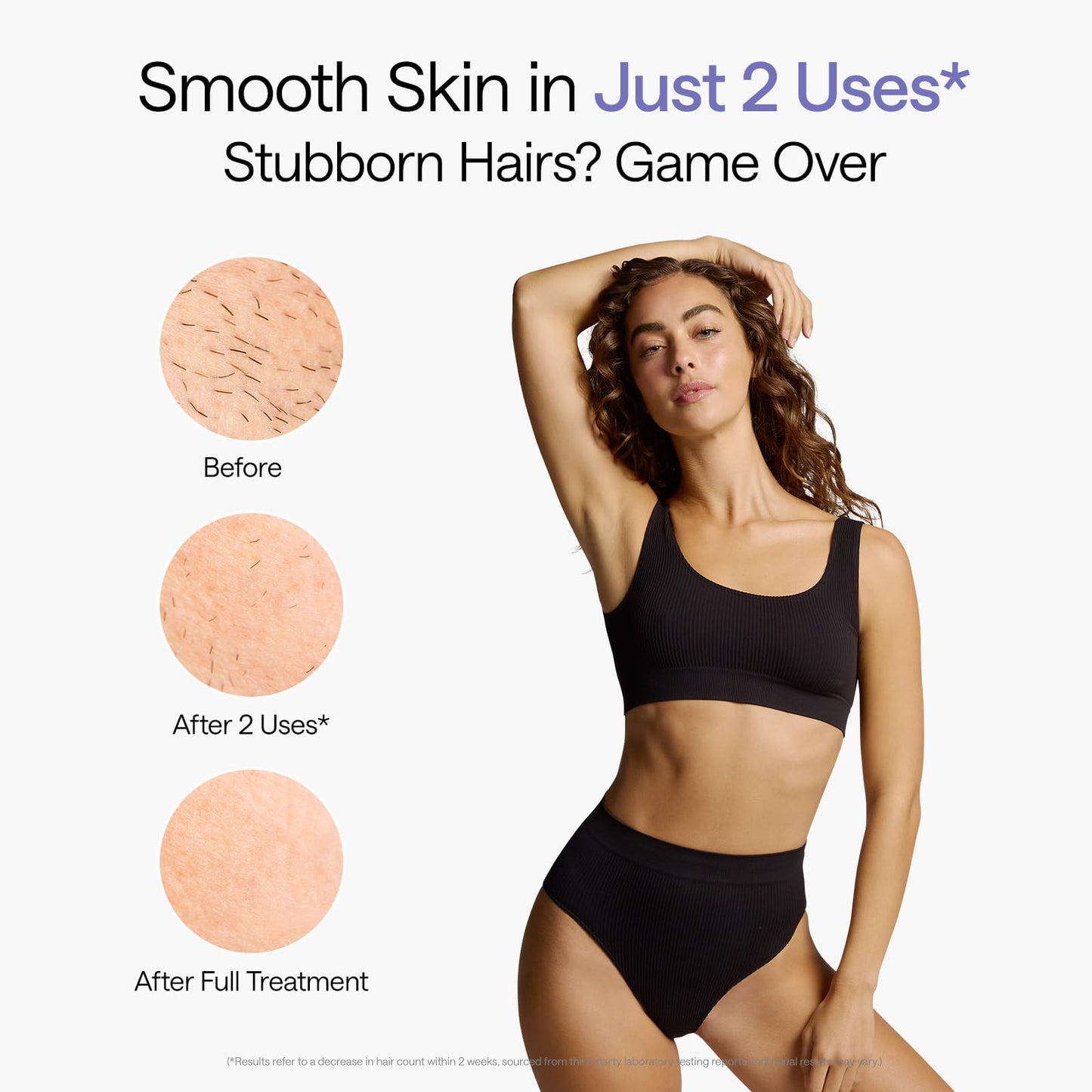 Ulike Air 10 Deluxe IPL, dual lights, skin sensor, fast results