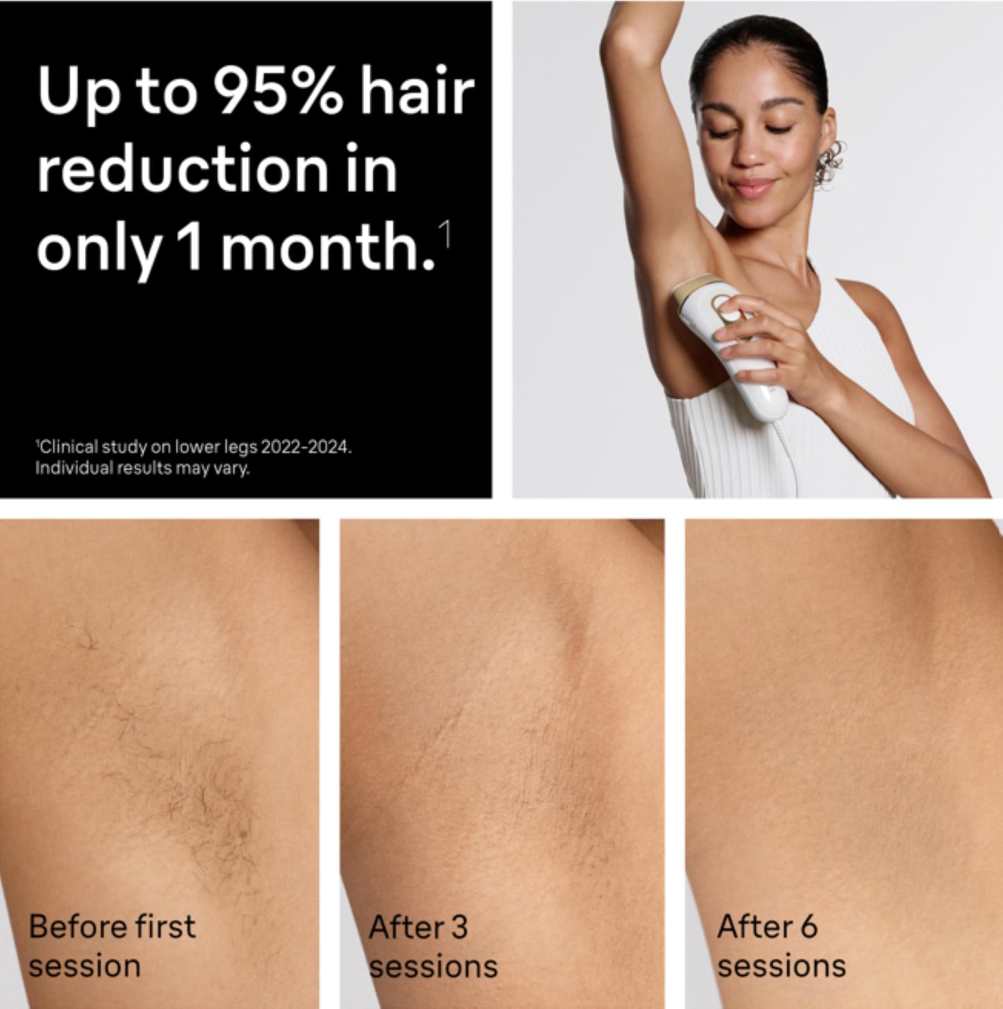 Braun Silk·Expert Pro 5 IPL5157, 2 heads, pouch & razor included