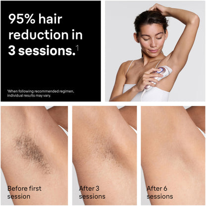 Braun Silk·Expert Pro 5 IPL5100, 1 head, permanent hair reduction