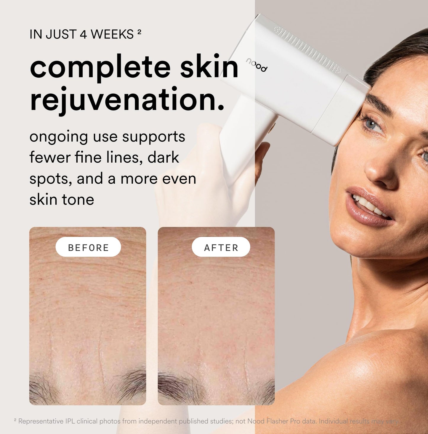 Nood Flasher Pro + serum, IPL device with slow hair regrowth formula